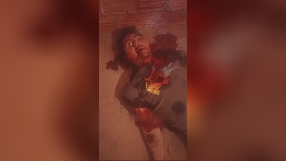 Arrested rapist is actually implemented, eyeball pops out