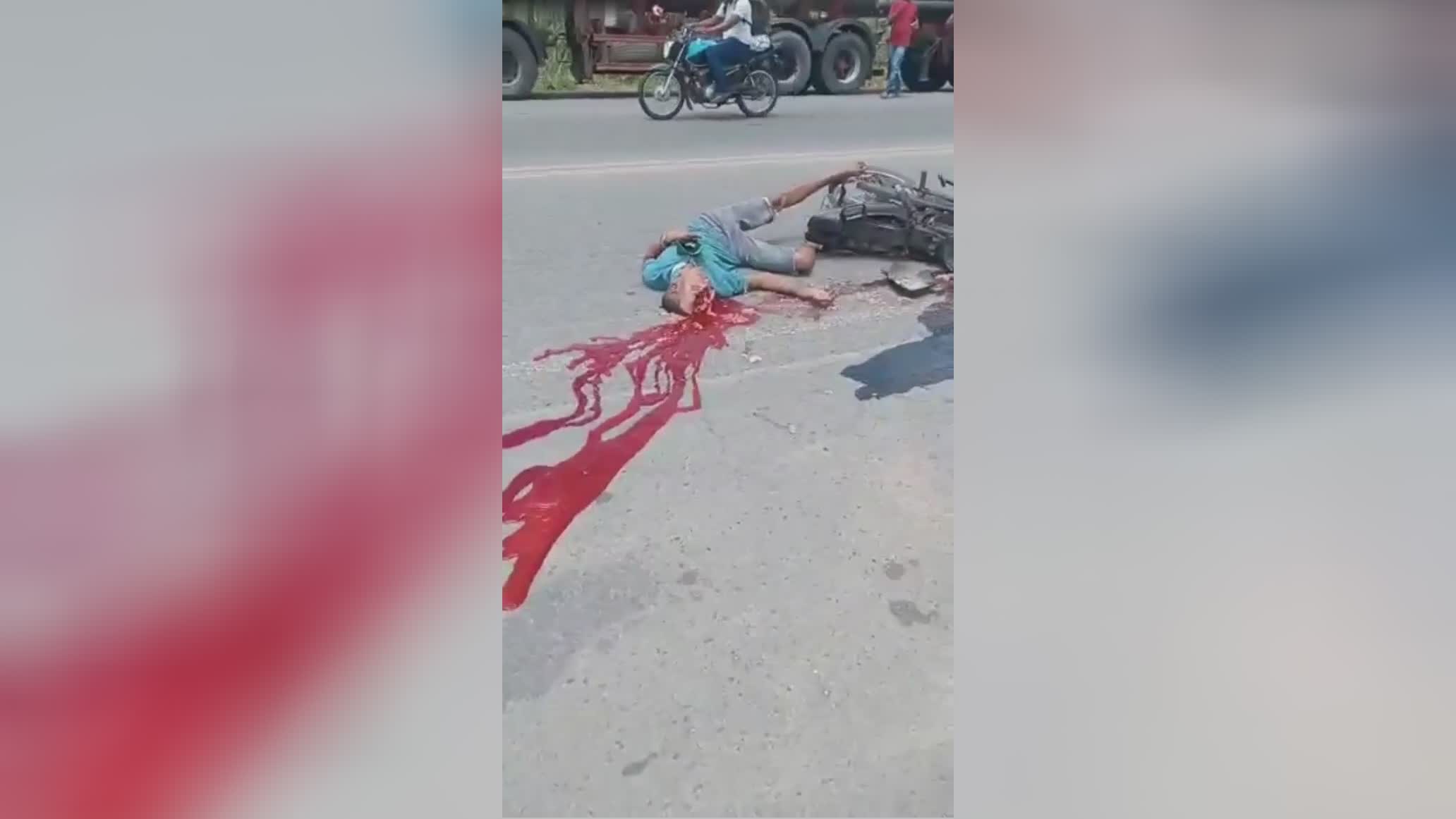 After a crash with a vehicle, the bicycle rider’s cranium ruptured