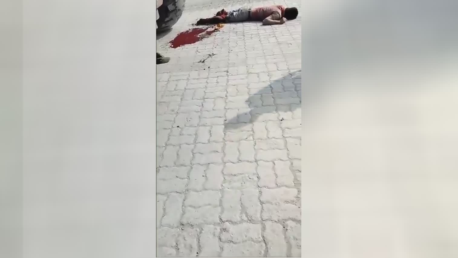 After the tractor passed, the guy possessed a single leg left behind