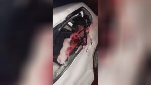 Scalp popped like a watermelon
