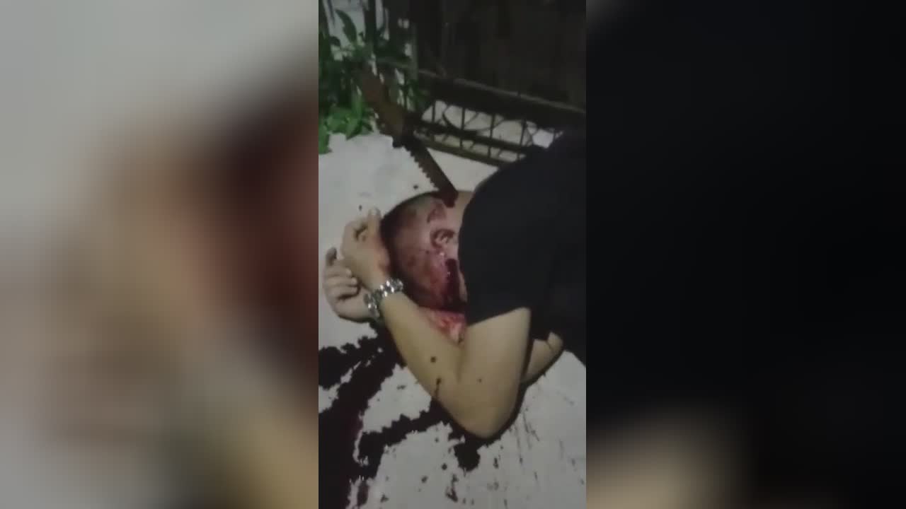 Knife stuck in guy’s head