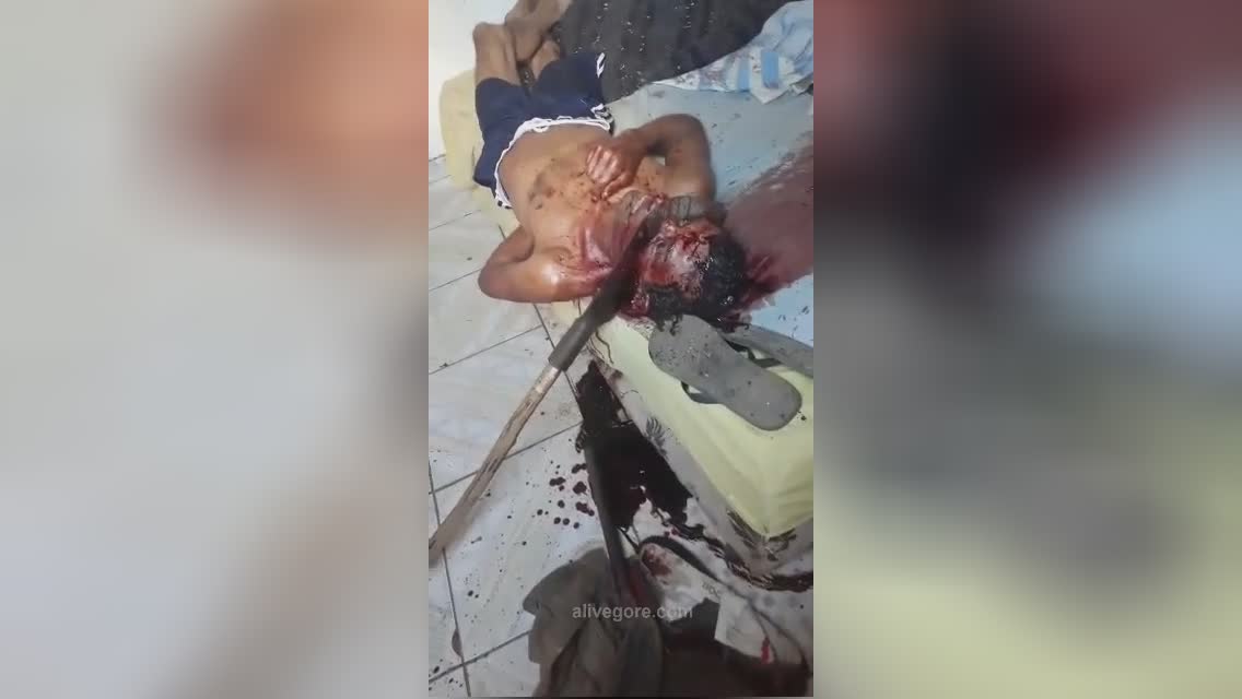 An axe was shoved into the face of a sleeping male uncensor