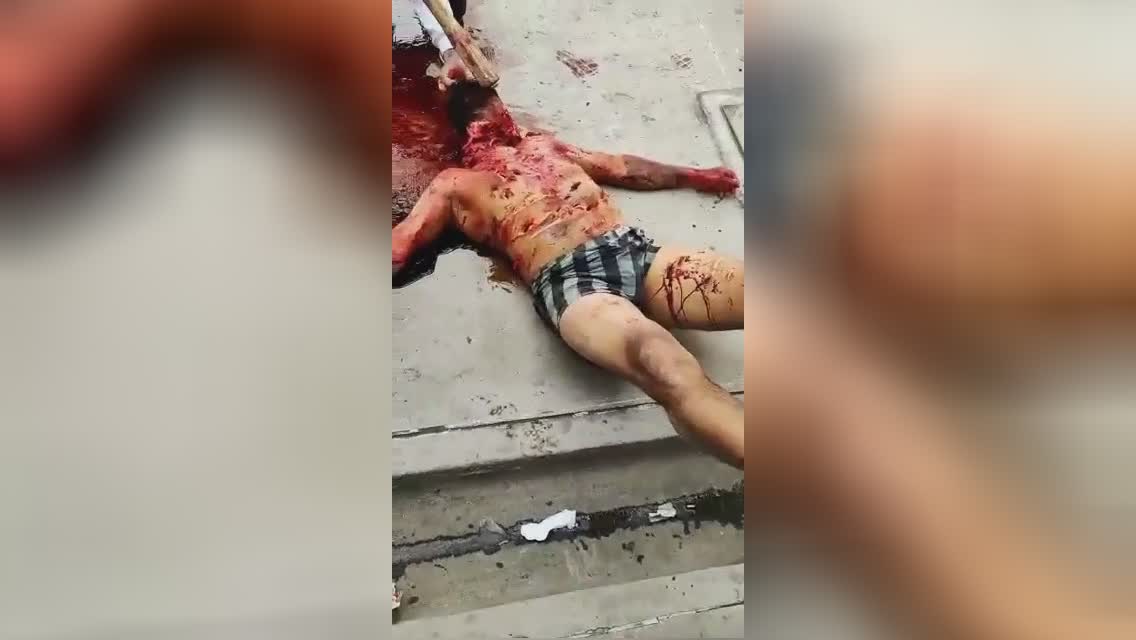 A bunch of guy along with blades transform a man’s body system into minced me