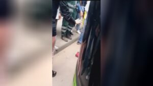 A bus ran over one lower leg of a female bogota 1 A bus ran over one lower leg of a female bogota