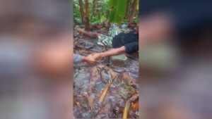 A pusher possessed his legs and upper arms faulty with a healthy