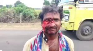 An inebriated indian motorcyclist along with his skin disfigured