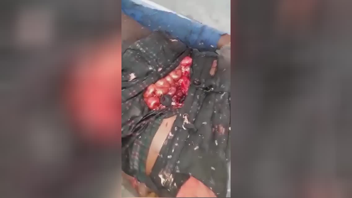 A guy sliced up his other half’s ex-lover after-effects