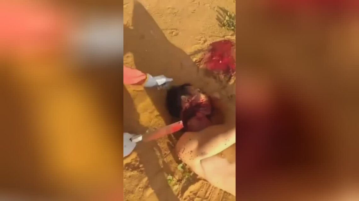 A man gets his scalp cut off along with a home kitchen axe