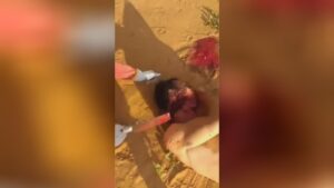 A man gets his scalp cut off along with a home kitchen axe 1 A man gets his scalp cut off along with a home kitchen axe