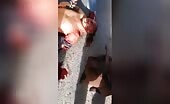 A man’s arm was actually torn off in an accident