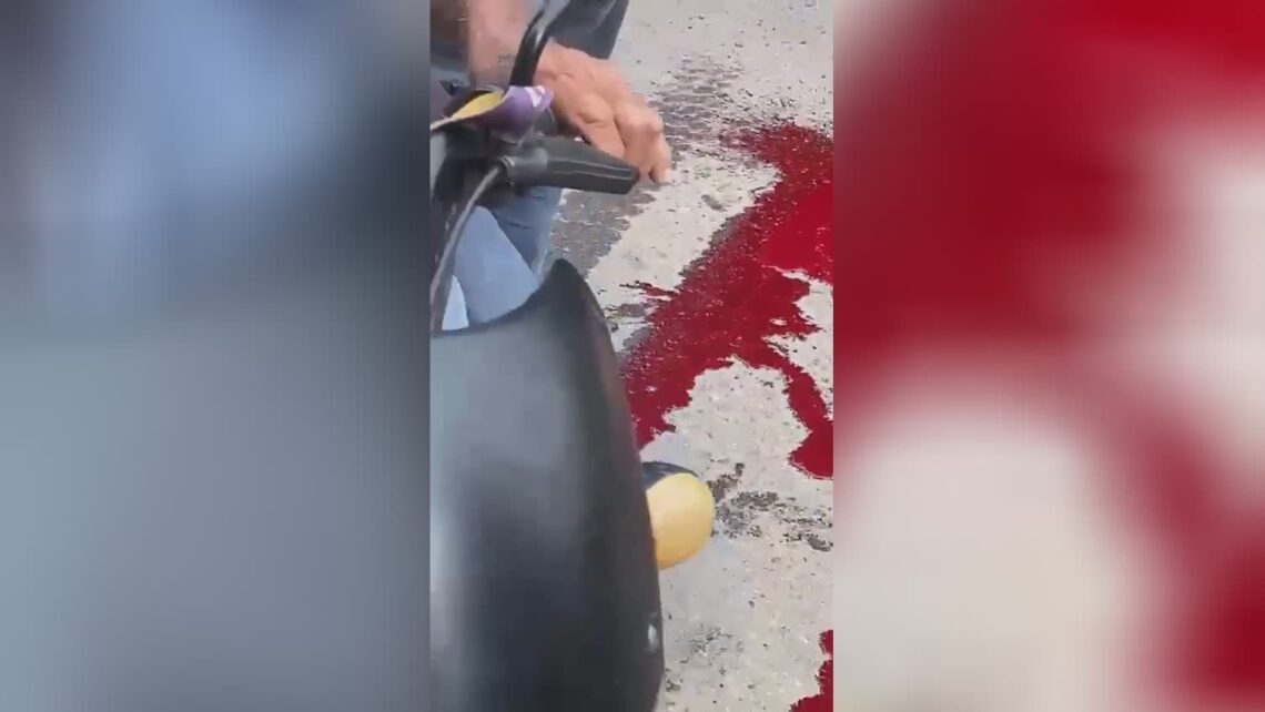 A guy’s legs was actually torn off after being hit by a truck