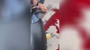 A guy's legs was actually torn off after being hit by a truck