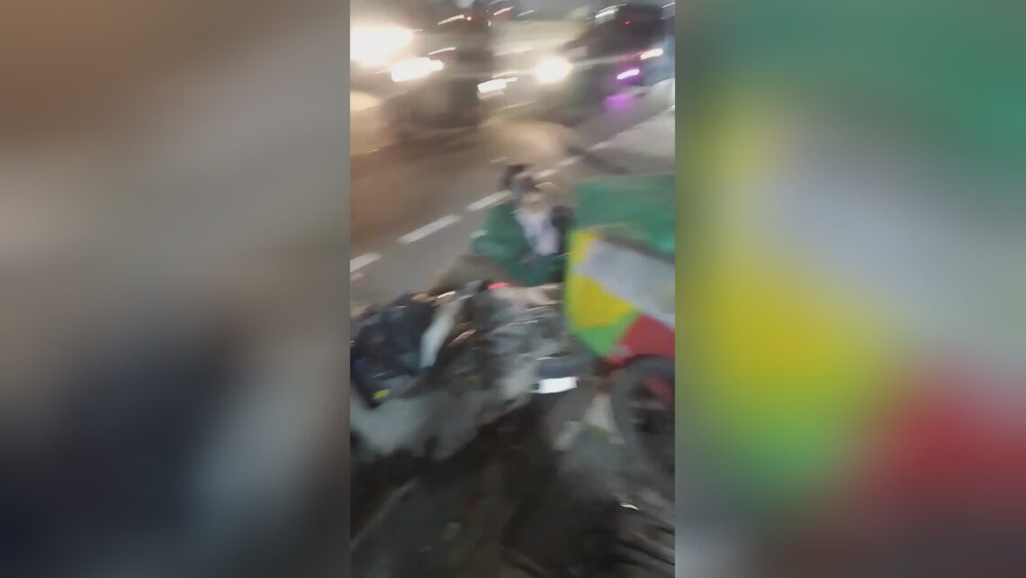 A metal pole pierced through the skin as well as cranium