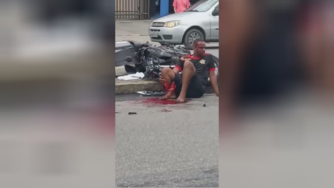 A motorcyclist that just became a one-legged male rests on the