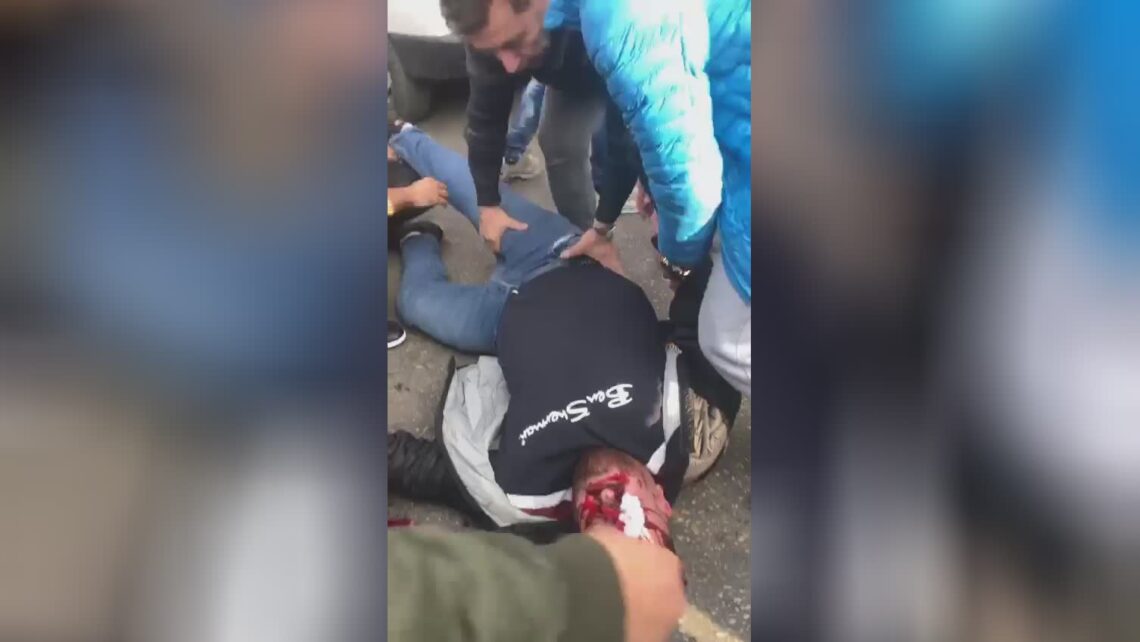 A street accident developed into a murder