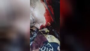 A female wheezing horribly along with her neck decrease
