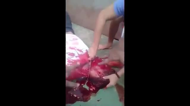 A group participant had his throat slice and also his tummy opened