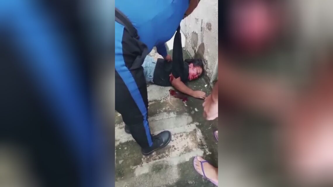 Drunk girl fell from the fourth floor consequences