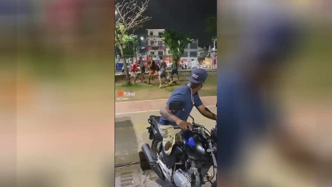 Man could not beginning his bike given that he failed to possess a lower leg