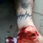 Man possesses an open leg crack - the foot is hung on the skin