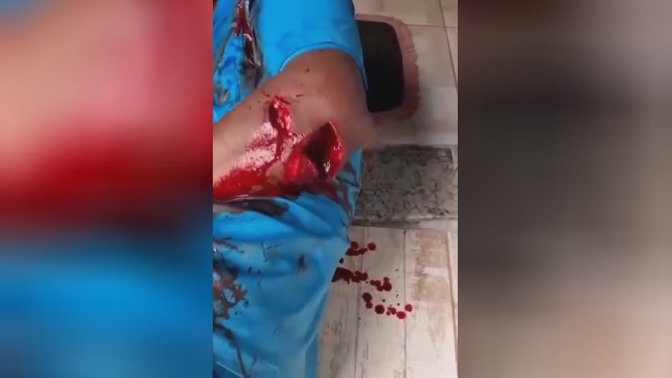 Dude is actually chopped up along with a machete