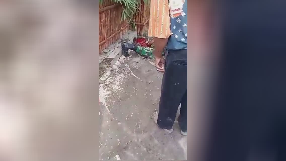 Guy is actually experiencing a brand-new sensation of life without one lower leg