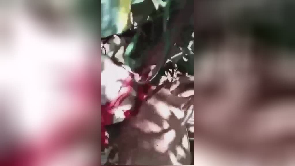 Dude with his oral cavity linked obtains his scalp cut off for a long time