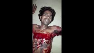 Lift accidentcutions