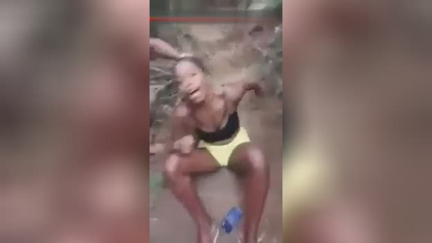 Deadly convulsions after being actually reached on the scalp