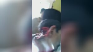 Horrendous machete strike to man along with hat