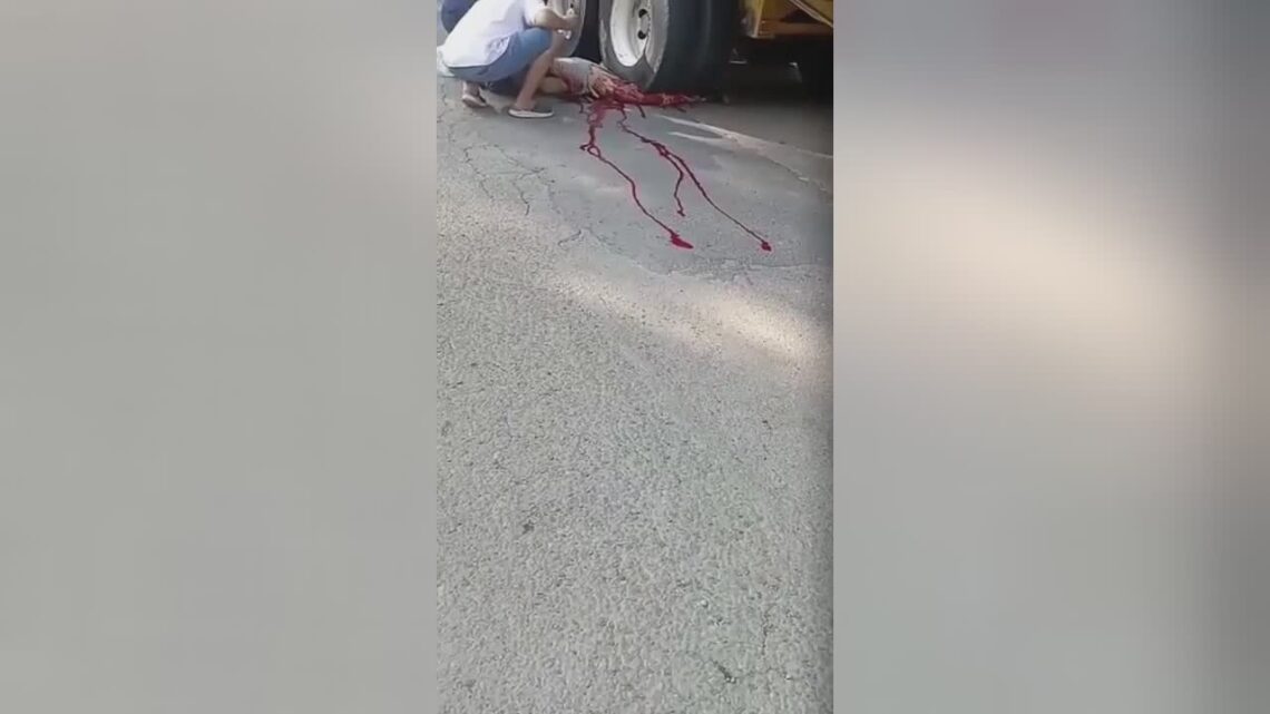 Reduced one-half of man’s body crushed by huge trailer