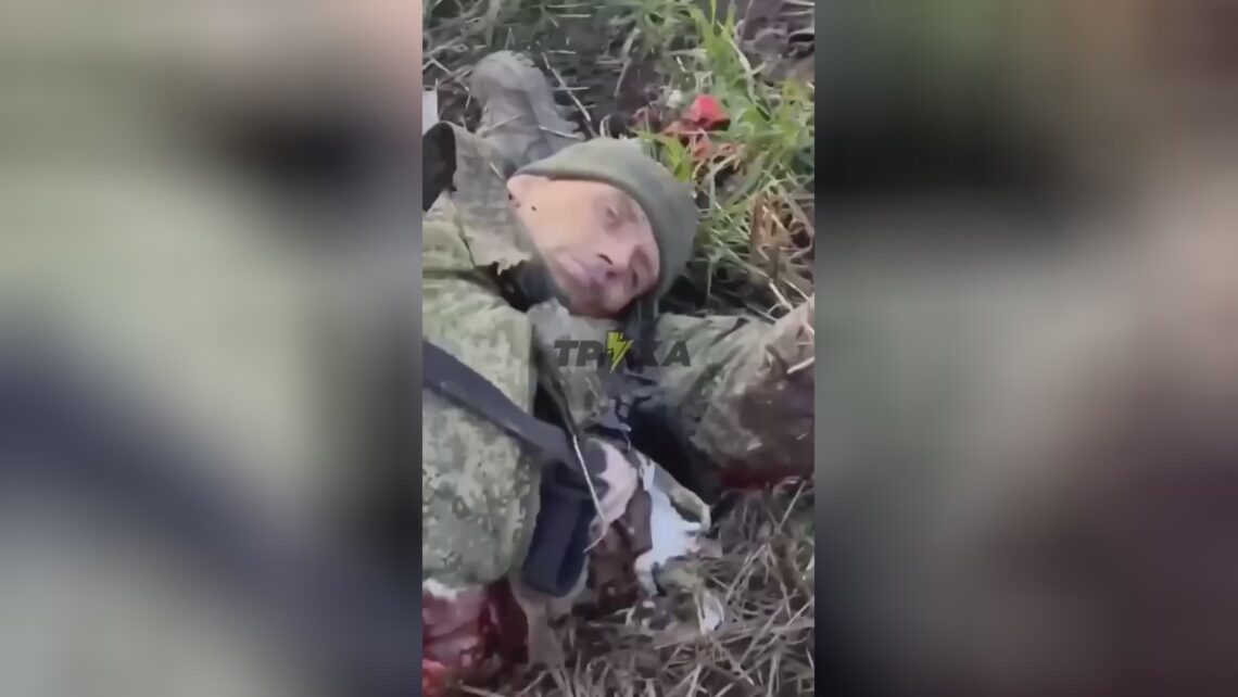 Russian military soldier possessed his leg torn off