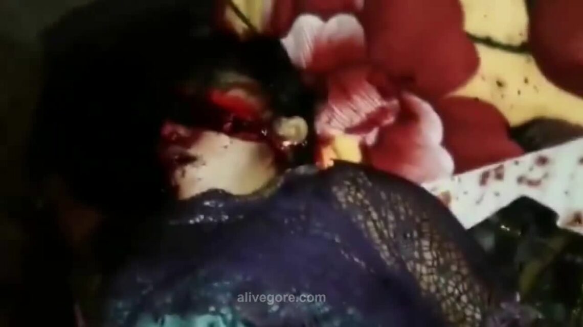 A perishing woman along with her head reduced across id