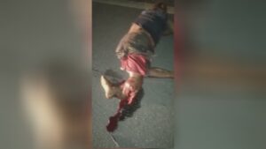 Broken legs after incident 1 Broken legs after incident