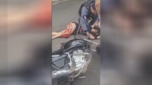 The meat of a lady's leg is torn off after a mishap