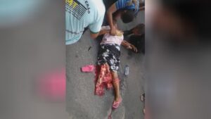 Woman crashed with shattered leg