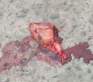 Dead Motorcyclist And His Still Beating Heart