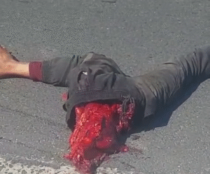 A Pedestrian Was Cut In Half When A Driver In A Bmw Sped Along Eisleben Road