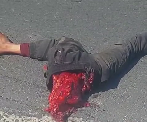 A Pedestrian Was Cut In Half When A Driver In A Bmw Sped Along Eisleben Road