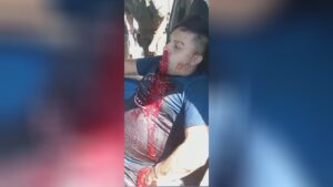 Due to a bullet cut in the belly