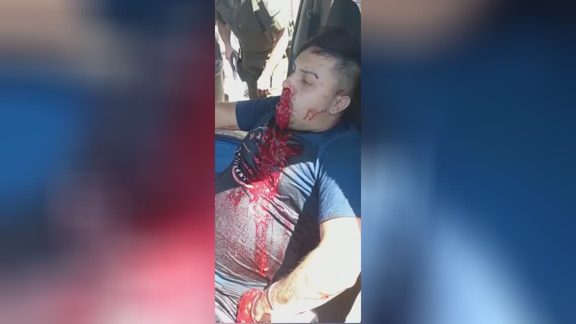 Due to a bullet cut in the belly