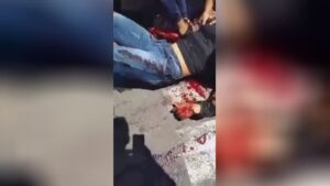 Due to the crash, the male's upper arm is putting up coming from