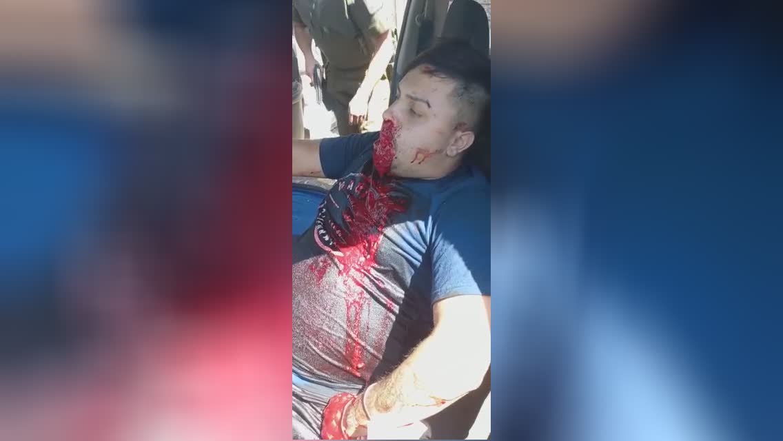 Chilean bank burglar throws up blood in terrible pain