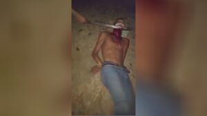 Removing the scalp along with a machete