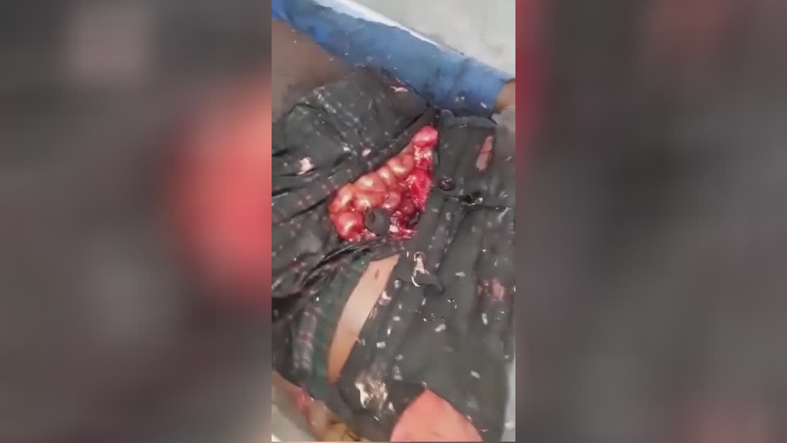 Lifeless guy got reached along with a machete several times