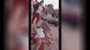 Consequencies of motorcycle accidents