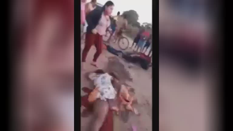 Consequencies of motorcycle accidents