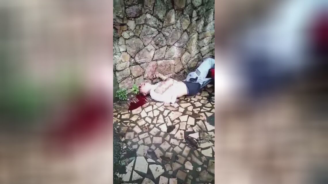 Motorcyclist’s brain was fractured when he attacked the wall surface after