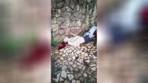 Motorcyclist's brain was fractured when he attacked the wall surface after