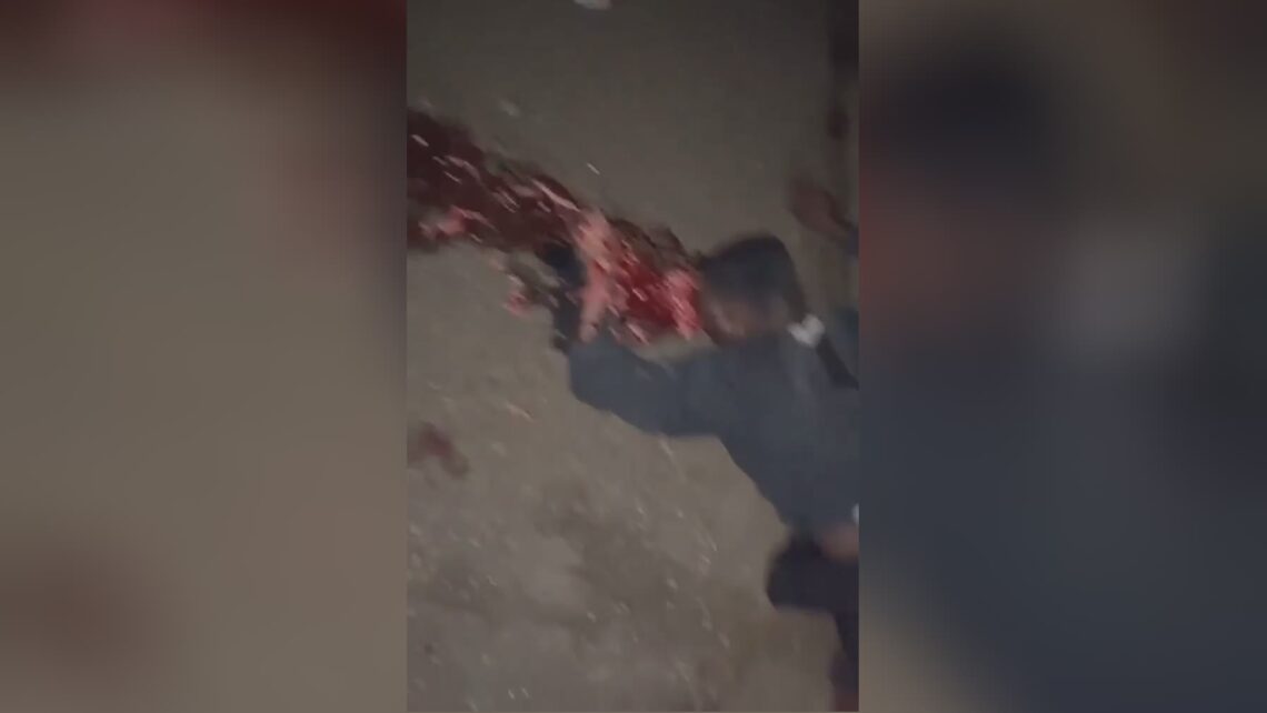 mutilated body of a man who fell from a motorcycle